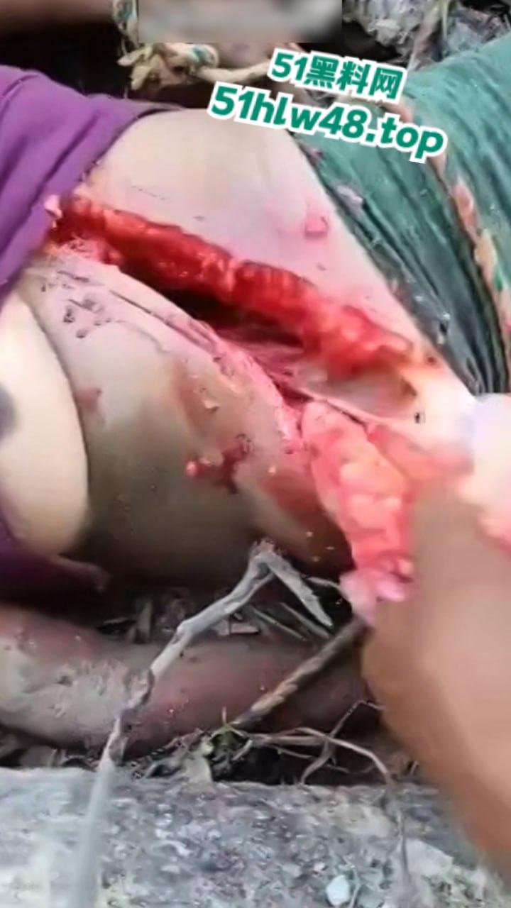 【恐怖血腥】国外大奶美女剖尸现场视频,大坨内脏被扯出,大奶美女和肥猪没啥区别。-4