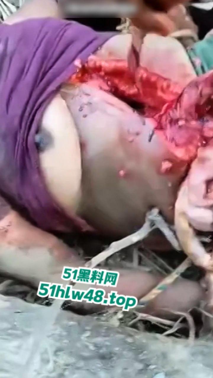 【恐怖血腥】国外大奶美女剖尸现场视频,大坨内脏被扯出,大奶美女和肥猪没啥区别。-5