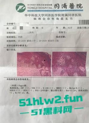 真实母子乱伦大瓜！儿子发现母亲的聊天记录后兽性大发，用手机拍视频录下与母亲的性爱视频曝光。-1