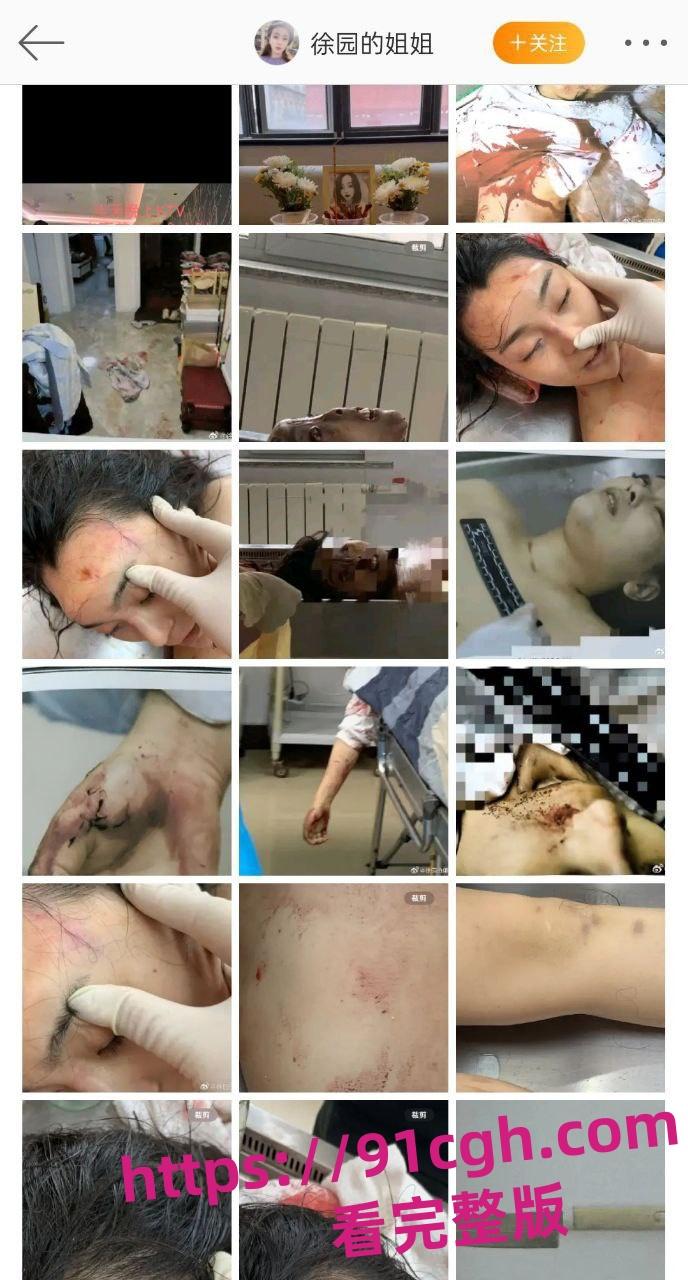 辽宁大连普兰店女孩 徐园 事件再起波澜 男子家中砍死女友 却被无罪释放！-3